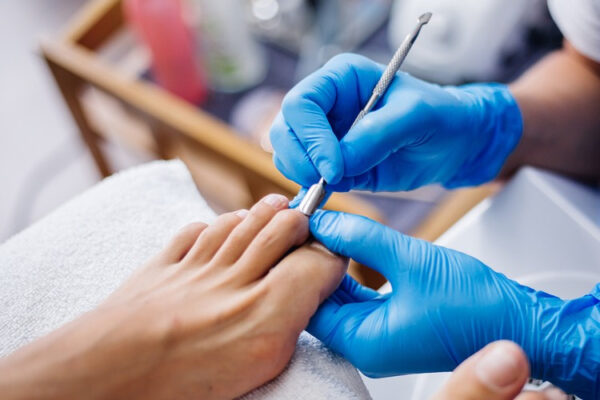 Ingrown Toenail Kit - Image 10